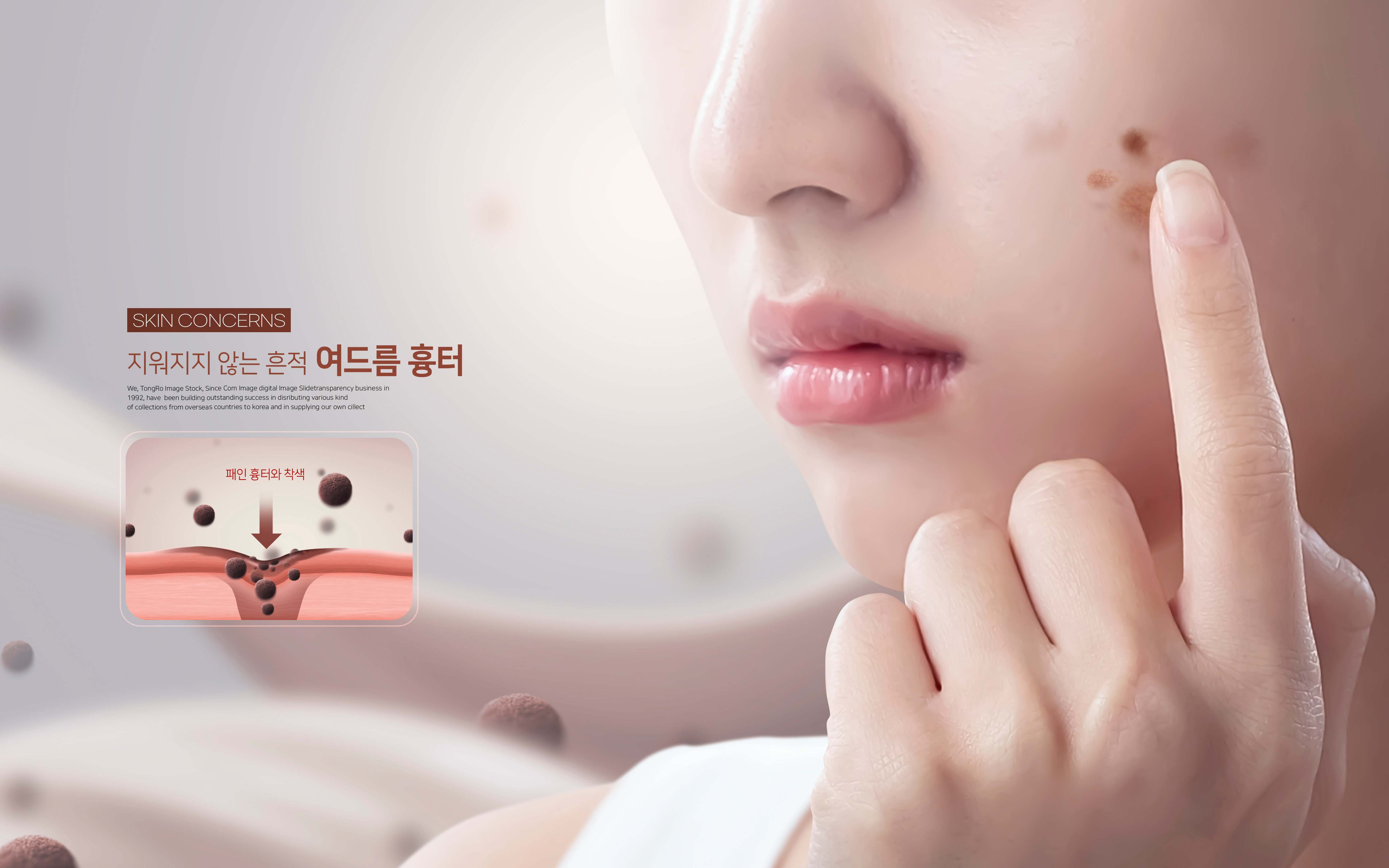 여드름 시술 완전 정복: 내 피부에 맞는 치료법 찾기