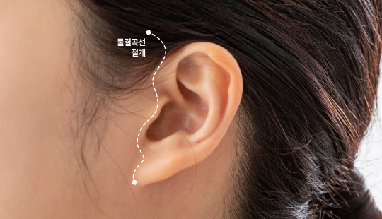 안면거상 흉살, 왜 생길까? 3대 원인과 관리 포인트