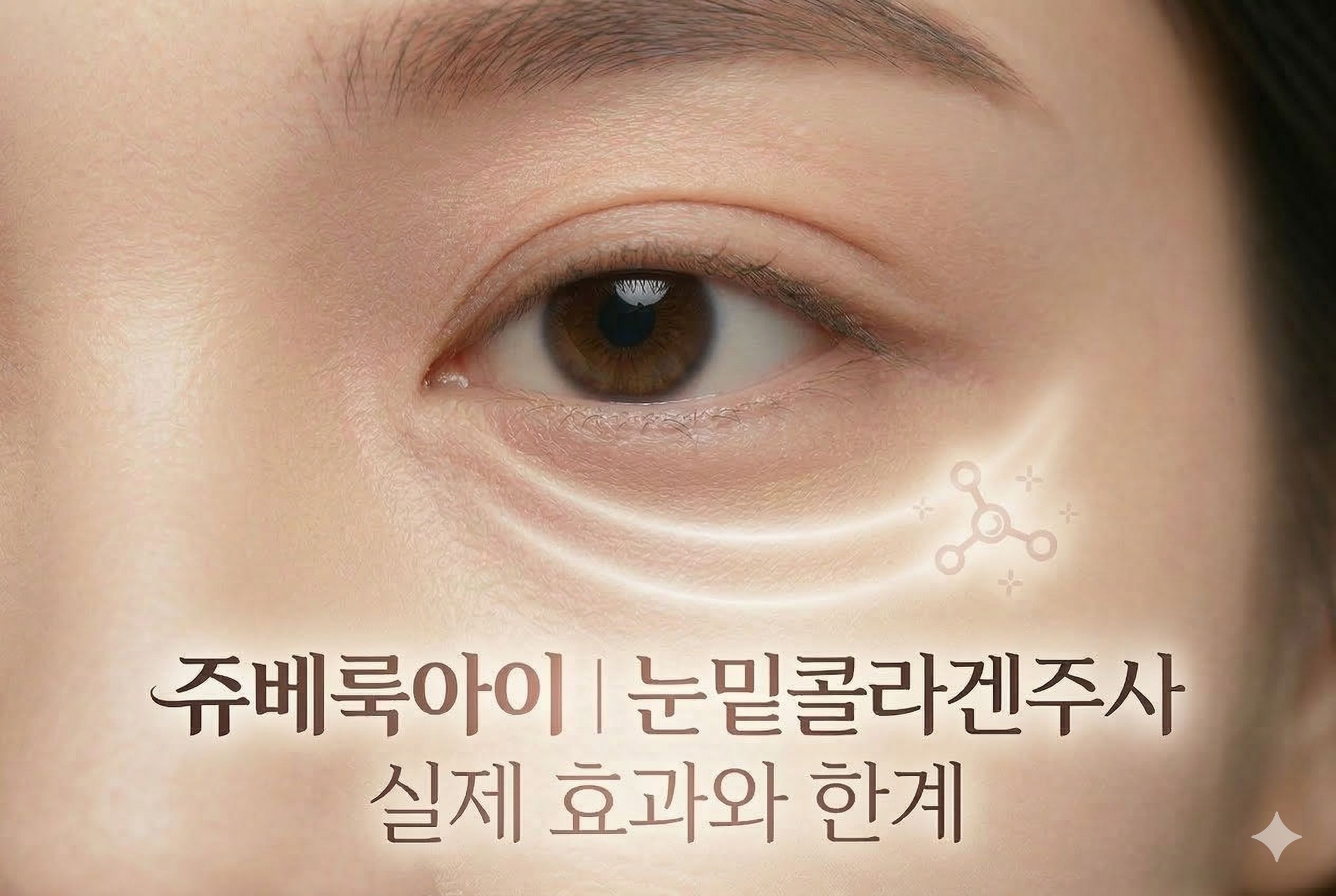 눈밑콜라겐주사 쥬베룩아이, 실제 효과와 한계