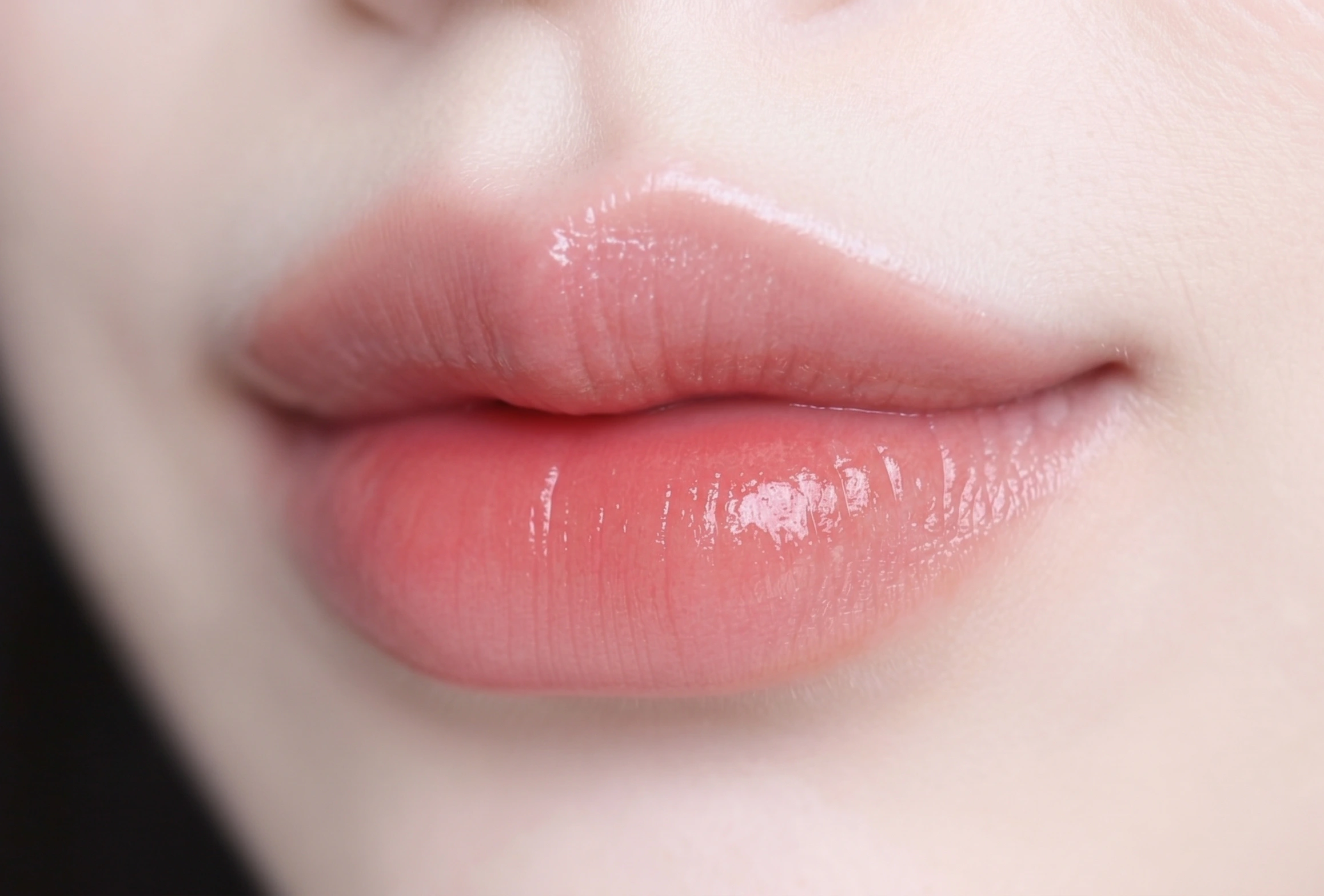 입매교정: 수술 없이 예쁜 입꼬리 만드는 방법 4가지