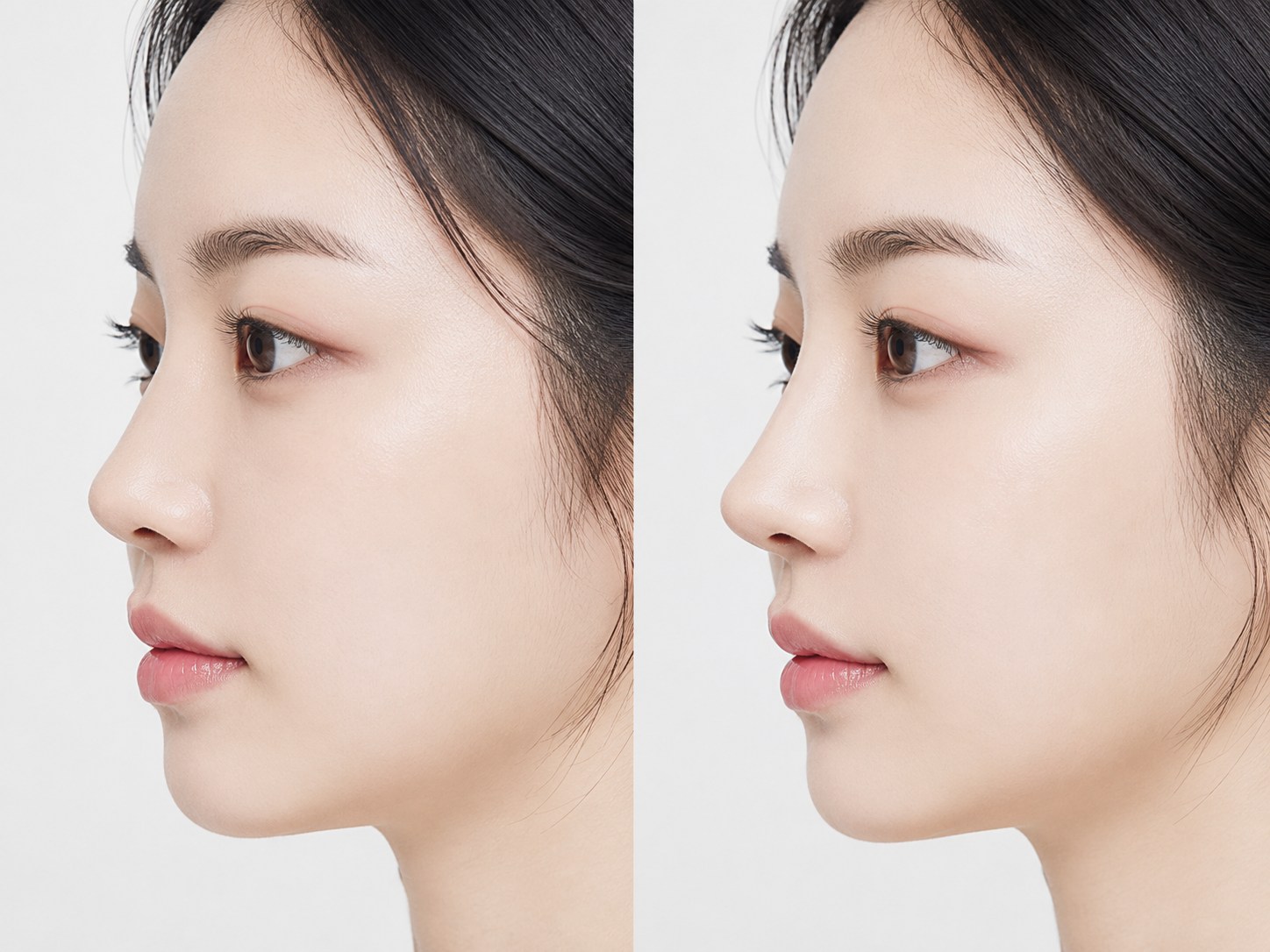 스테로이드 없는 코조각주사: 장단점과 시술 가이드