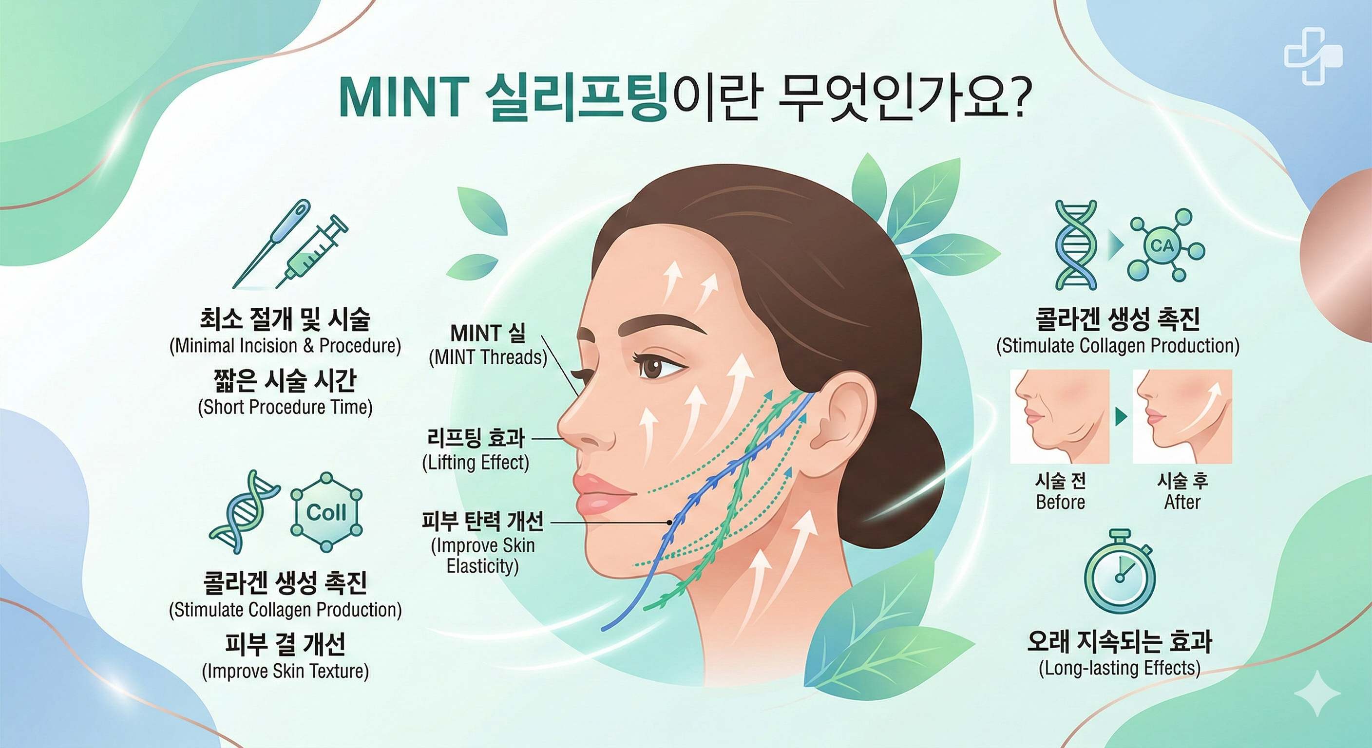 2026년 민트실리프팅 가격 완전 해부: 부위·줄 수·이벤트별 총정리