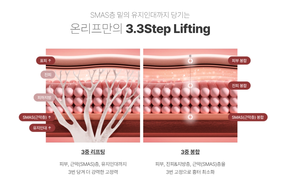 미니거상 흉터 걱정, 현실과 오해 - 수술 전후 꼭 알아야 할 팁