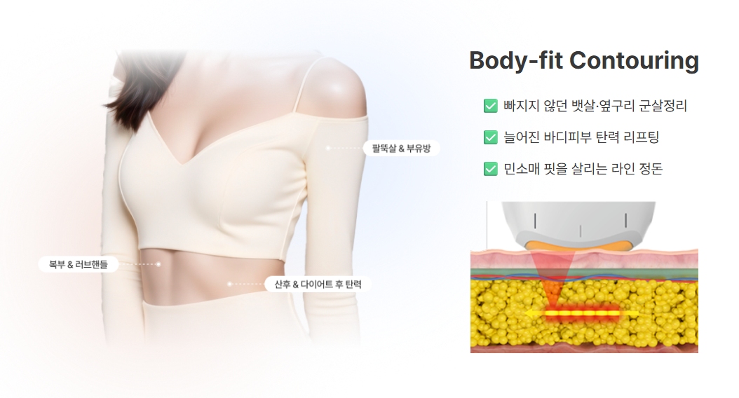 뱃살 리프팅 울트라인 : 진짜 효과와 주의사항 총정리